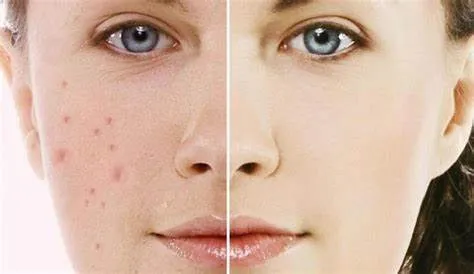 Các liệu pháp điều trị chuyên nghiệp tại spa và phòng khám da liễu