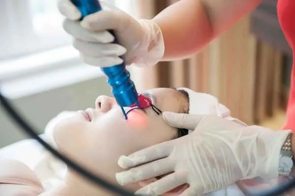 Các trường hợp mụn nào phù hợp với điều trị bằng laser?
