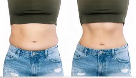 Cơ chế hoạt động của phương pháp hút mỡ bụng