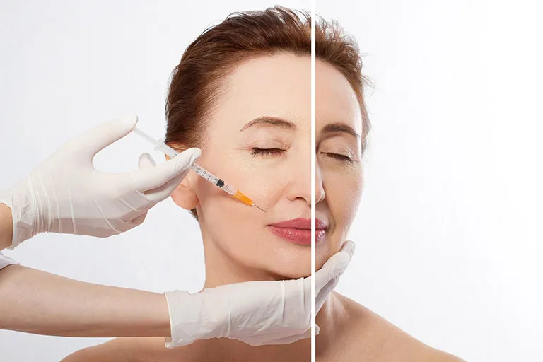 Filler là gì? Thành phần chính và nguồn gốc