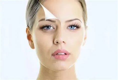 Giảm béo bằng sóng RF giá bao nhiêu? Yếu tố ảnh hưởng đến chi phí