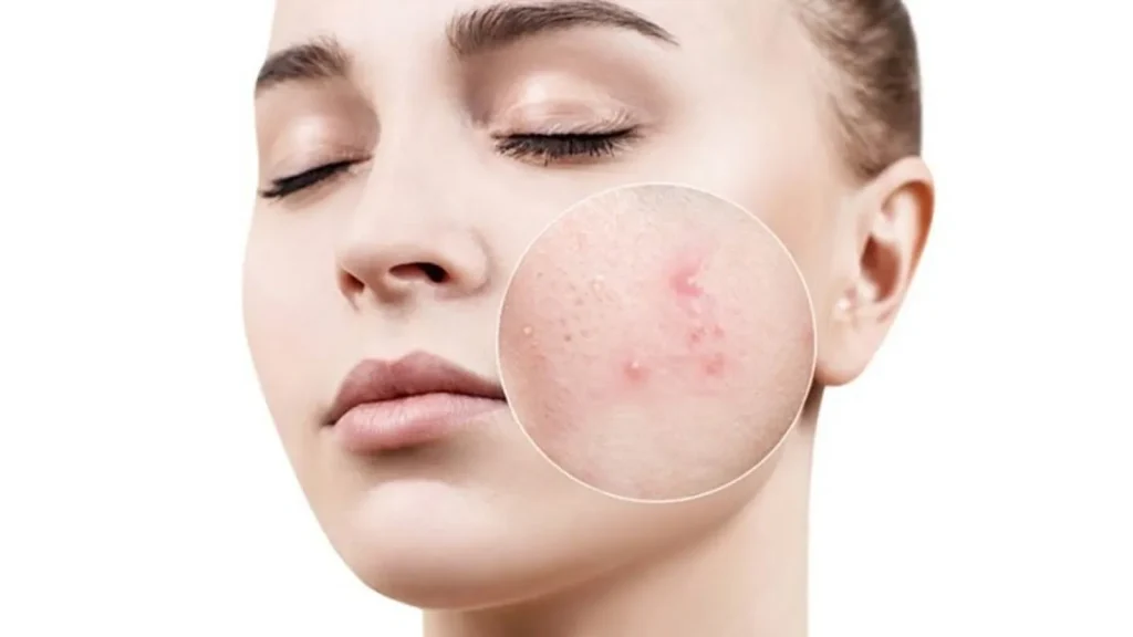Lựa chọn sữa rửa mặt phù hợp: Dành cho da dầu, da hỗn hợp thiên dầu, da nhạy cảm...