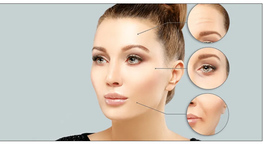 Những điều cần biết trước khi tiêm Botox