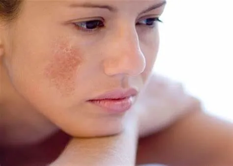 Những thay đổi tự nhiên của làn da ở độ tuổi trung niên
