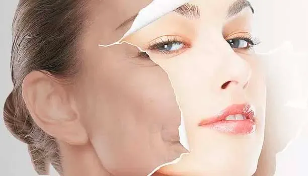 Peel da sinh học là gì? "Lột xác" cho làn da bằng cách tự nhiên