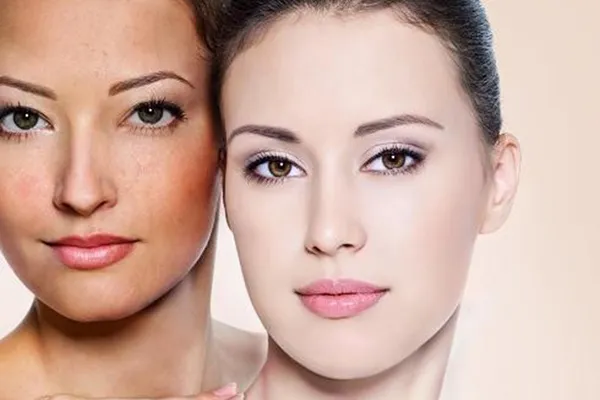 Tác động của ánh nắng mặt trời