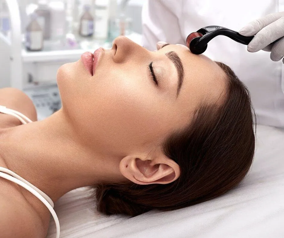 Tại sao chăm sóc da sau lăn kim lại quan trọng đến vậy?