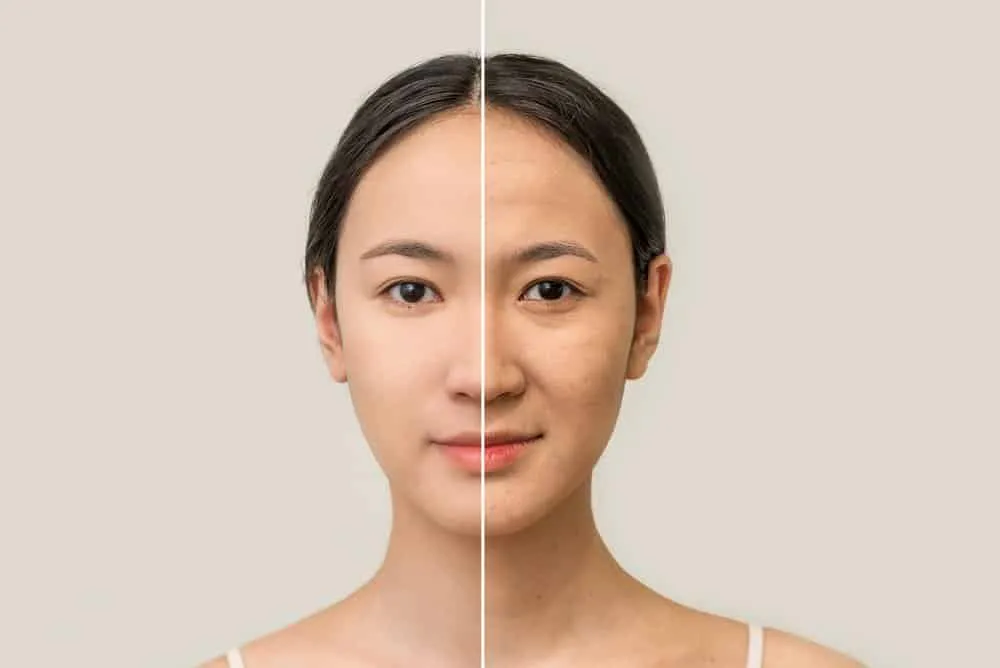 Tẩy tế bào chết định kỳ