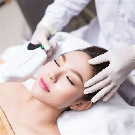 Thế nào là căng da mặt không phẫu thuật? Tại sao phương pháp này ngày càng được ưa chuộng?