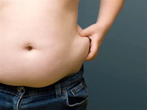 Tình trạng sức khỏe của bạn - Điều kiện tiên quyết để hút mỡ an toàn