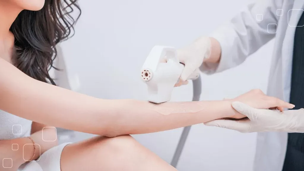 Triệt Lông Vĩnh Viễn: Hiểu Đúng Để Đẹp Đúng Cách