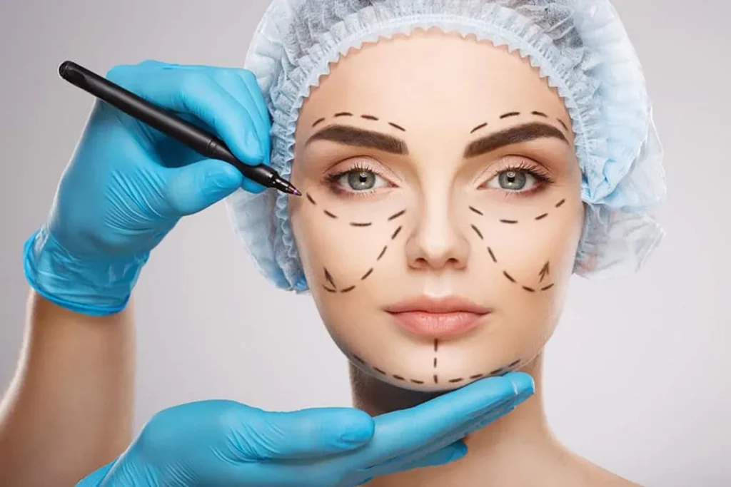 Ultherapy: Nâng cơ, xóa nhăn bằng sóng siêu âm hội tụ