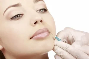 botox là gì