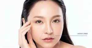 dịch vụ xóa nếp nhăn hiệu quả