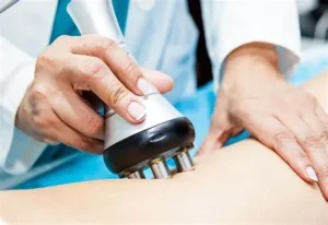 giảm béo bằng sóng RF
