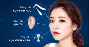 nâng mũi cấu trúc là gì
